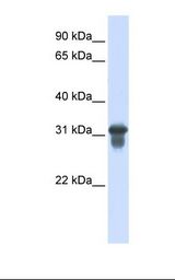 SLC25A11 Antibody - Transfected 293T cell lysate. Antibody concentration: 1.0 ug/ml. Gel concentration: 12%.  This image was taken for the unconjugated form of this product. Other forms have not been tested.