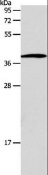 SLC25A11 Antibody - Western blot analysis of Human lymphoma tissue, using SLC25A11 Polyclonal Antibody at dilution of 1:600.