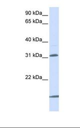 SLC25A11 Antibody - 721_B cell lysate. Antibody concentration: 1.0 ug/ml. Gel concentration: 12%.  This image was taken for the unconjugated form of this product. Other forms have not been tested.