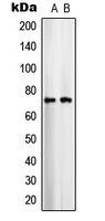 SLC25A12 / ARALAR Antibody - Western blot analysis of ARALAR1 expression in COLO205 (A); U251MG (B) whole cell lysates.