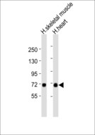 SLC25A12 / ARALAR Antibody - All lanes : Anti-ARALAR1 Antibody at 1:1000 dilution Lane 1: human skeletal muscle lysates Lane 2: human heart lysates Lysates/proteins at 20 ug per lane. Secondary Goat Anti-Rabbit IgG, (H+L),Peroxidase conjugated at 1/10000 dilution Predicted band size : 75 kDa Blocking/Dilution buffer: 5% NFDM/TBST.