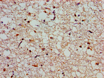 SLC25A12 / ARALAR Antibody - Immunohistochemistry image of paraffin-embedded human brain tissue at a dilution of 1:100