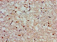 SLC25A12 / ARALAR Antibody - Immunohistochemistry image of paraffin-embedded human brain tissue at a dilution of 1:100