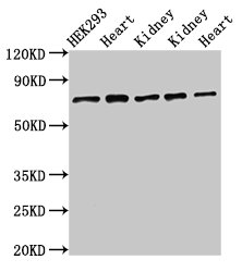 SLC25A12 / ARALAR Antibody - Positive Western Blot detected in Rat heart tissue, Rat kidney tissue, Mouse kidney tissue, Mouse heart tissue. All lanes: SLC25A12 antibody at 3 µg/ml Secondary Goat polyclonal to rabbit IgG at 1/50000 dilution. Predicted band size: 75, 63 KDa. Observed band size: 75 KDa