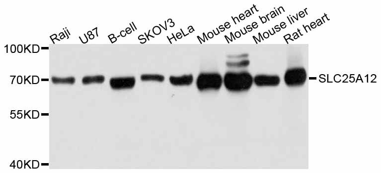 SLC25A12 / ARALAR Antibody - Western blot analysis of extracts of various cell lines, using SLC25A12 antibody at 1:3000 dilution. The secondary antibody used was an HRP Goat Anti-Rabbit IgG (H+L) at 1:10000 dilution. Lysates were loaded 25ug per lane and 3% nonfat dry milk in TBST was used for blocking. An ECL Kit was used for detection and the exposure time was 1s.
