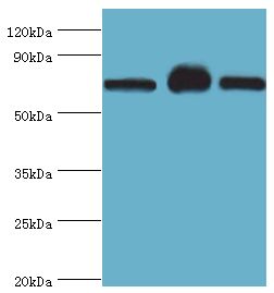 SLC25A13 / CITRIN Antibody - Western blot. All lanes: Calcium-binding mitochondrial carrier protein Aralar2 antibody at 4 ug/ml. Lane 1: mouse liver tissue. Lane 2: mouse kidney tissue. Lane 2: HepG2 whole cell lysate. secondary Goat polyclonal to rabbit at 1:10000 dilution. Predicted band size: 74 kDa. Observed band size: 74 kDa.