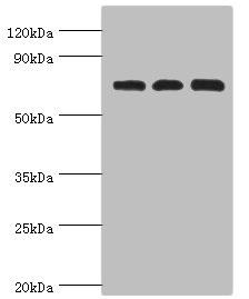 SLC25A13 / CITRIN Antibody - Western blot All lanes: Calcium-binding mitochondrial carrier protein Aralar2 antibody at 4µg/ml Lane 1: Mouse liver tissue Lane 2: Mouse kidney tissue Lane 2: HepG2 whole cell lysate Secondary Goat polyclonal to rabbit IgG at 1/10000 dilution Predicted band size: 74 kDa Observed band size: 74 kDa