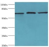 SLC25A13 / CITRIN Antibody - Western blot. All lanes: Calcium-binding mitochondrial carrier protein Aralar2 antibody at 3 ug/ml. Lane 1: mouse liver tissue. Lane 2: mouse kidney tissue. Lane 3: HepG2 whole cell lysate. secondary Goat polyclonal to rabbit at 1:10000 dilution. Predicted band size: 74 kDa. Observed band size: 74 kDa.