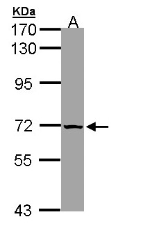 SLC25A13 / CITRIN Antibody - Sample (30 ug of whole cell lysate). A:293T. 7.5% SDS PAGE. SLC25A13 / CITRIN antibody diluted at 1:1000.