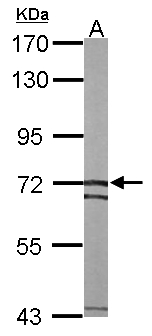 SLC25A13 / CITRIN Antibody - Sample (50 ug of whole cell lysate). A: mouse liver. 7.5% SDS PAGE. SLC25A13 / CITRIN antibody diluted at 1:1000.