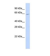 SLC25A13 / CITRIN Antibody - Western blot of Human 721_B. SLC25A13 antibody dilution 1.0 ug/ml.  This image was taken for the unconjugated form of this product. Other forms have not been tested.