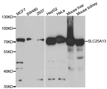 SLC25A13 / CITRIN Antibody - Western blot analysis of extracts of various cell lines.