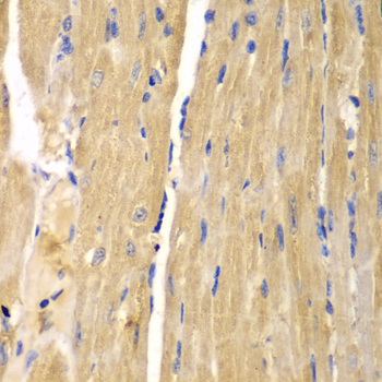 SLC25A13 / CITRIN Antibody - Immunohistochemistry of paraffin-embedded mouse heart.