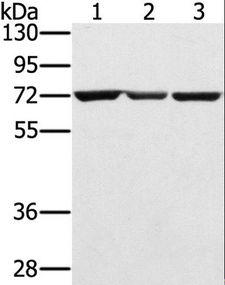 SLC25A13 / CITRIN Antibody - Western blot analysis of Hepg2, A172 and Raji cell, using SLC25A13 Polyclonal Antibody at dilution of 1:450.