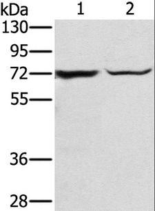 SLC25A13 / CITRIN Antibody - Western blot analysis of Mouse liver tissue and hepg2 cell, using SLC25A13 Polyclonal Antibody at dilution of 1:450.