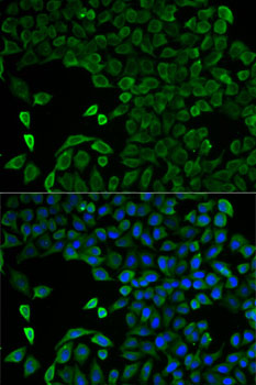 SLC25A13 / CITRIN Antibody - Immunofluorescence analysis of U2OS cells using SLC25A13 antibody. Blue: DAPI for nuclear staining.