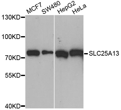 SLC25A13 / CITRIN Antibody - Western blot analysis of extracts of various cell lines, using SLC25A13 antibody at 1:1000 dilution. The secondary antibody used was an HRP Goat Anti-Rabbit IgG (H+L) at 1:10000 dilution. Lysates were loaded 25ug per lane and 3% nonfat dry milk in TBST was used for blocking. An ECL Kit was used for detection and the exposure time was 90s.