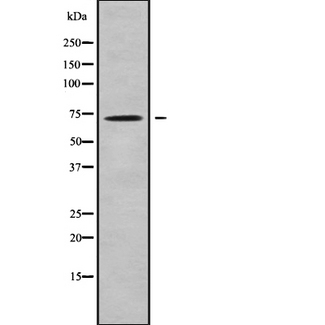 SLC25A13 / CITRIN Antibody - Western blot analysis SLC25A13 using K562 whole cells lysates