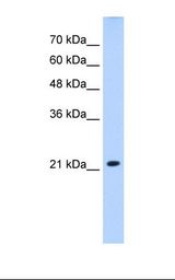 SLC25A14 / UCP5 Antibody - Jurkat cell lysate. Antibody concentration: 2.5 ug/ml. Gel concentration: 12%.  This image was taken for the unconjugated form of this product. Other forms have not been tested.