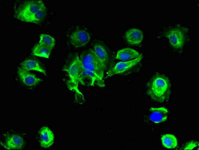 SLC25A14 / UCP5 Antibody - Immunofluorescent analysis of MCF-7 cells using SLC25A14 Antibody at dilution of 1:100 and Alexa Fluor 488-congugated AffiniPure Goat Anti-Rabbit IgG(H+L)