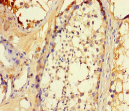 SLC25A14 / UCP5 Antibody - Immunohistochemistry of paraffin-embedded human testis tissue using SLC25A14 Antibody at dilution of 1:100