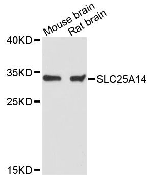 SLC25A14 / UCP5 Antibody - Western blot analysis of extracts of various cell lines, using SLC25A14 antibody at 1:3000 dilution. The secondary antibody used was an HRP Goat Anti-Rabbit IgG (H+L) at 1:10000 dilution. Lysates were loaded 25ug per lane and 3% nonfat dry milk in TBST was used for blocking. An ECL Kit was used for detection and the exposure time was 30s.