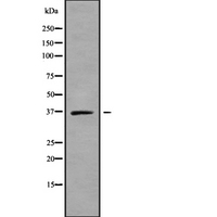 SLC25A14 / UCP5 Antibody - Western blot analysis SLC25A14 using K562 whole cells lysates