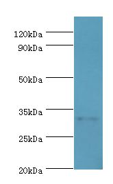 SLC25A15 / ORNT1 Antibody - Western blot. All lanes: SLC25A15 antibody at 6 ug/ml+mouse liver tissue. Secondary antibody: Goat polyclonal to rabbit at 1:10000 dilution. Predicted band size: 33 kDa. Observed band size: 33 kDa.