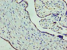 SLC25A15 / ORNT1 Antibody - Immunohistochemistry of paraffin-embedded human placenta tissue using antibody at 1:100 dilution.