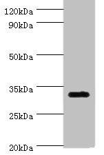 SLC25A15 / ORNT1 Antibody - Western blot All lanes: SLC25A15 antibody at 6µg/ml + Mouse liver tissue Secondary Goat polyclonal to rabbit IgG at 1/10000 dilution Predicted band size: 33 kDa Observed band size: 33 kDa