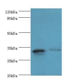SLC25A15 / ORNT1 Antibody - Western blot. All lanes: SLC25A15 antibody at 6 ug/ml. Lane 1: mouse liver tissue. Lane 2: mouse stomach tissue. Secondary antibody: Goat polyclonal to rabbit at 1:10000 dilution. Predicted band size: 33 kDa. Observed band size: 33 kDa.