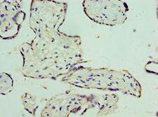 SLC25A15 / ORNT1 Antibody - Immunohistochemistry of paraffin-embedded human placenta tissue using antibody at 1:100 dilution.