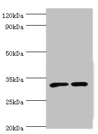 SLC25A15 / ORNT1 Antibody - Western blot All lanes: SLC25A15 antibody at 6µg/ml Lane 1: Mouse liver tissue Lane 2: Mouse stomach tissue Secondary Goat polyclonal to rabbit IgG at 1/10000 dilution Predicted band size: 33 kDa Observed band size: 33 kDa