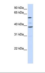 SLC25A16 / GDA / Graves Antibody - 721_B cell lysate. Antibody concentration: 1.0 ug/ml. Gel concentration: 12%.  This image was taken for the unconjugated form of this product. Other forms have not been tested.
