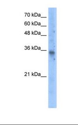 SLC25A16 / GDA / Graves Antibody - Transfected 293T cell lysate. Antibody concentration: 5.0 ug/ml. Gel concentration: 12%.  This image was taken for the unconjugated form of this product. Other forms have not been tested.