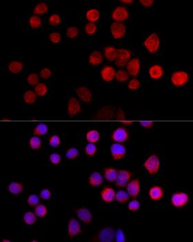 SLC25A17 Antibody - Immunofluorescence analysis of 293T cells using SLC25A17 Polyclonal Antibody at dilution of 1:100 (40x lens).Blue: DAPI for nuclear staining.