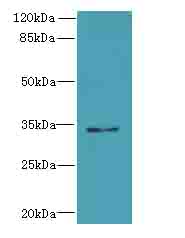 SLC25A18 Antibody - Western blot. All lanes: SLC25A18 antibody at 0.3 ug/ml+U84- whole cell lysate Goat polyclonal to rabbit at 1:10000 dilution. Predicted band size: 34 kDa. Observed band size: 34 kDa.