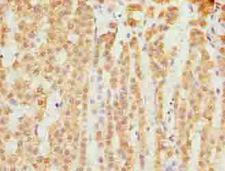 SLC25A18 Antibody - Immunohistochemistry of paraffin-embedded human adrenal gland tissue using antibody at dilution of 1:100.