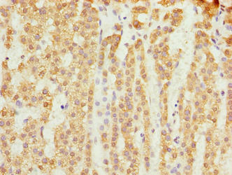 SLC25A18 Antibody - Immunohistochemistry of paraffin-embedded human adrenal gland tissue using SLC25A18 Antibody at dilution of 1:100