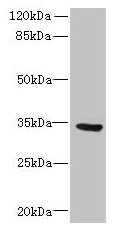 SLC25A18 Antibody - Western blot All lanes: SLC25A18 antibody at 0.3µg/ml + U87 whole cell lysate Secondary Goat polyclonal to rabbit IgG at 1/10000 dilution Predicted band size: 34 kDa Observed band size: 34 kDa