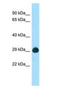 SLC25A2 Antibody - SLC25A2 antibody Western Blot of Fetal Heart.  This image was taken for the unconjugated form of this product. Other forms have not been tested.