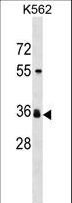 SLC25A2 Antibody - ORNT2 Antibody western blot of K562 cell line lysates (35 ug/lane). The ORNT2 antibody detected the ORNT2 protein (arrow).