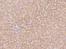 SLC25A2 Antibody - Immunochemical staining of human SLC25A2 in human liver with rabbit polyclonal antibody at 1:100 dilution, formalin-fixed paraffin embedded sections.