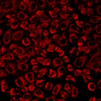 SLC25A20 / CACT Antibody