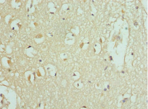 SLC25A20 / CACT Antibody - Immunohistochemistry of paraffin-embedded human brain tissue at dilution 1:100