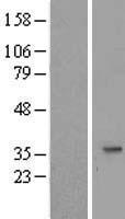 SLC25A20 / CACT Protein - Western validation with an anti-DDK antibody * L: Control HEK293 lysate R: Over-expression lysate