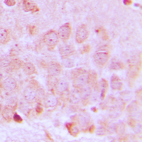 SLC25A21 / ODC1 Antibody - Immunohistochemical analysis of ODC staining in human brain formalin fixed paraffin embedded tissue section. The section was pre-treated using heat mediated antigen retrieval with sodium citrate buffer (pH 6.0). The section was then incubated with the antibody at room temperature and detected using an HRP conjugated compact polymer system. DAB was used as the chromogen. The section was then counterstained with hematoxylin and mounted with DPX.