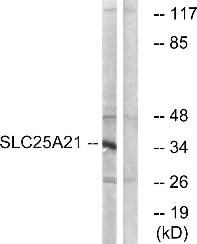 SLC25A21 / ODC1 Antibody - Western blot analysis of extracts from HepG2 cells, using SLC25A21 antibody.