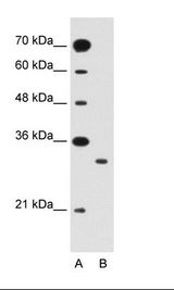 SLC25A22 / GC1 Antibody - A: Marker, B: Jurkat Cell Lysate.  This image was taken for the unconjugated form of this product. Other forms have not been tested.
