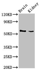 SLC25A23 Antibody - Western Blot Positive WB detected in:Mouse brain tissue,Mouse kidney tissue All Lanes:SLC25A23 antibody at 3µg/ml Secondary Goat polyclonal to rabbit IgG at 1/50000 dilution Predicted band size: 53,50,55,49 KDa Observed band size: 53 KDa
